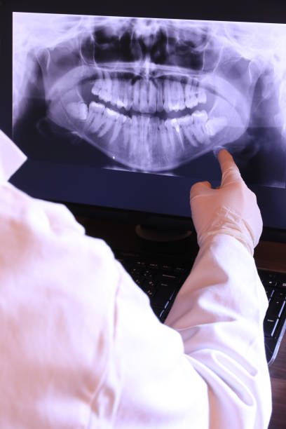 Best Emergency Tooth Extraction in Hopewell, NJ